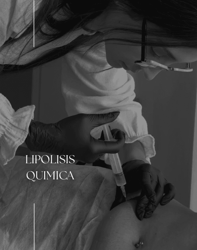 Lipólisis Química