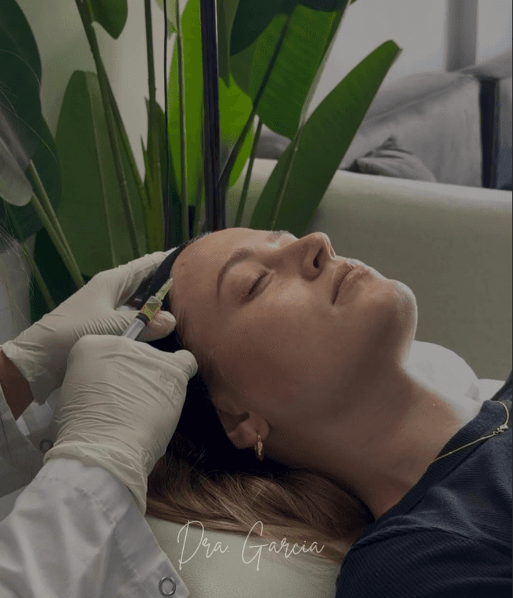Mesoterapia Capilar